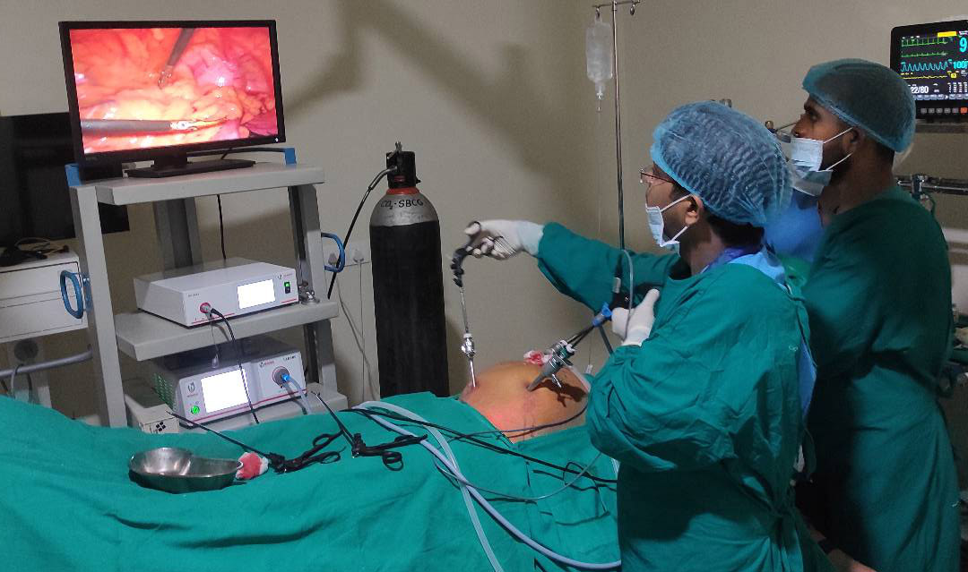 laparoscopy_surgery 