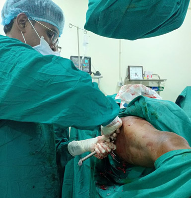  lapro_surgery
