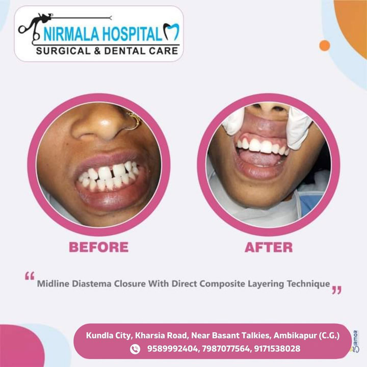 dental-3