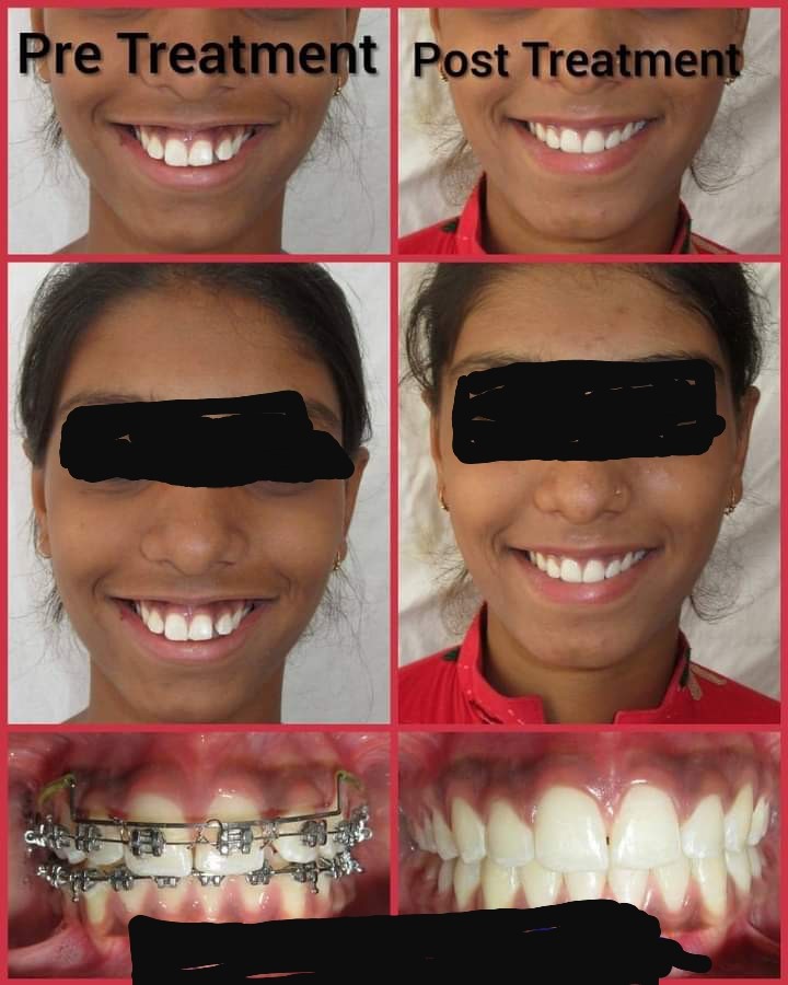 dental-1 